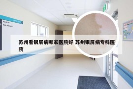 苏州看银屑病哪家医院好 苏州银屑病专科医院
