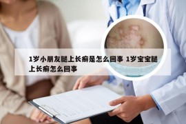 1岁小朋友腿上长癣是怎么回事 1岁宝宝腿上长癣怎么回事