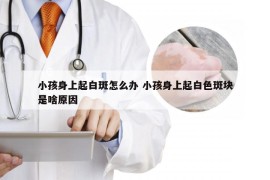 小孩身上起白斑怎么办 小孩身上起白色斑块是啥原因