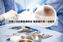 只得一次的银屑病特征 银屑病只发一次概率