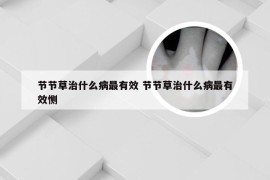 节节草治什么病最有效 节节草治什么病最有效恻