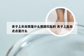 鼻子上长白斑是什么原因引起的 鼻子上起白点点是什么