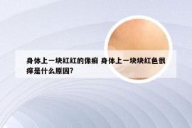 身体上一块红红的像癣 身体上一块块红色很痒是什么原因?