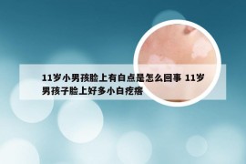 11岁小男孩脸上有白点是怎么回事 11岁男孩子脸上好多小白疙瘩