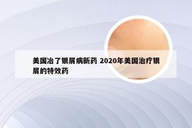 美国冶了银屑病新药 2020年美国治疗银屑的特效药