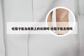 吃茄子能治皮肤上的白斑吗 吃茄子能去斑吗