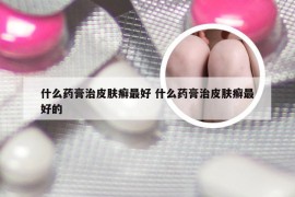 什么药膏治皮肤癣最好 什么药膏治皮肤癣最好的