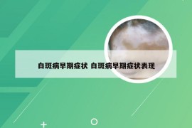 白斑病早期症状 白斑病早期症状表现