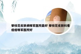 攀枝花皮肤病哪家医院最好 攀枝花皮肤科看痘痘哪家医院好