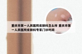 重庆市第一人民医院皮肤科怎么样 重庆市第一人民医院皮肤科专家门诊时间