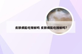 皮肤病能吃辣椒吗 皮肤病能吃辣椒吗?