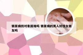 银屑病找对象困难吗 银屑病的男人好找女朋友吗