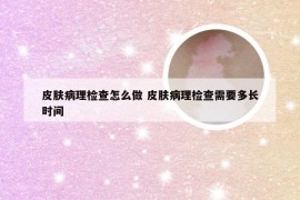 皮肤病理检查怎么做 皮肤病理检查需要多长时间