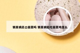 银屑病忌口韭菜吗 银屑病能吃韭菜鸡蛋么