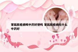 掌跖脓疱病喝中药好使吗 掌跖脓疱病吃什么中药好