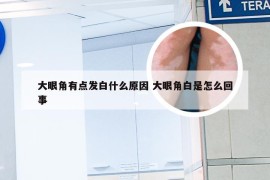 大眼角有点发白什么原因 大眼角白是怎么回事