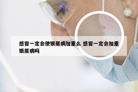 感冒一定会使银屑病加重么 感冒一定会加重银屑病吗