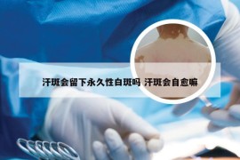 汗斑会留下永久性白斑吗 汗斑会自愈嘛