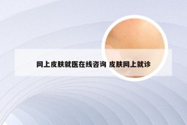 网上皮肤就医在线咨询 皮肤网上就诊