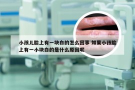 小孩儿脸上有一块白的怎么回事 如果小孩脸上有一小块白的是什么原因呢