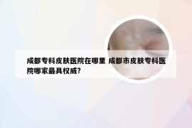 成都专科皮肤医院在哪里 成都市皮肤专科医院哪家最具权威?