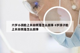 六岁小孩脸上长白斑是怎么回事 6岁孩子脸上长白斑是怎么回事