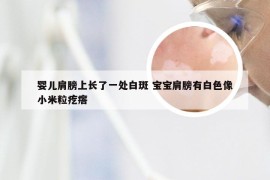 婴儿肩膀上长了一处白斑 宝宝肩膀有白色像小米粒疙瘩