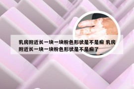 乳房附近长一块一块粉色形状是不是癣 乳房附近长一块一块粉色形状是不是癣了