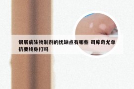 银屑病生物制剂的优缺点有哪些 司库奇尤单抗要终身打吗