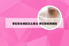 掌跎脓包病因怎么根治 掌砣脓疱病病因