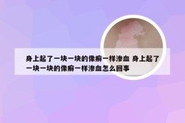 身上起了一块一块的像癣一样渗血 身上起了一块一块的像癣一样渗血怎么回事