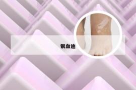 银血迪