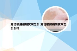潍坊银屑病研究院怎么 潍坊银屑病研究院怎么么样
