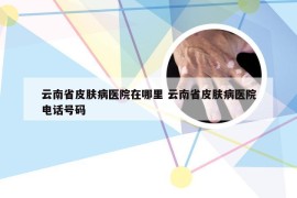 云南省皮肤病医院在哪里 云南省皮肤病医院电话号码