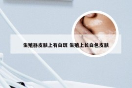 生殖器皮肤上有白斑 生殖上长白色皮肤