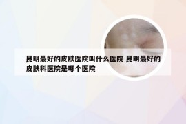 昆明最好的皮肤医院叫什么医院 昆明最好的皮肤科医院是哪个医院