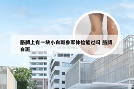 胳膊上有一块小白斑参军体检能过吗 胳膊 白斑