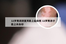 12岁男孩到夏天脸上起白班 12岁男孩子脸上长白印