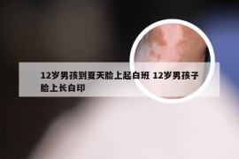 12岁男孩到夏天脸上起白班 12岁男孩子脸上长白印