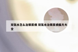 双氧水怎么治银屑病 双氧水治银屑病偏方大全