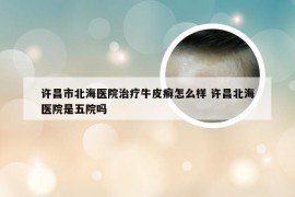 许昌市北海医院治疗牛皮癣怎么样 许昌北海医院是五院吗