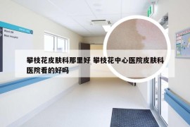 攀枝花皮肤科那里好 攀枝花中心医院皮肤科医院看的好吗