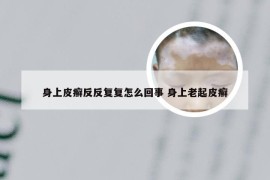 身上皮癣反反复复怎么回事 身上老起皮癣