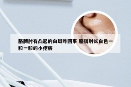 胳膊肘有凸起的白斑咋回事 胳膊肘长白色一粒一粒的小疙瘩