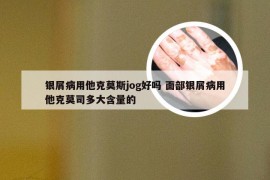 银屑病用他克莫斯jog好吗 面部银屑病用他克莫司多大含量的