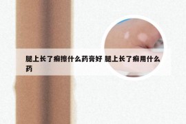 腿上长了癣擦什么药膏好 腿上长了癣用什么药