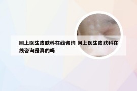 网上医生皮肤科在线咨询 网上医生皮肤科在线咨询是真的吗