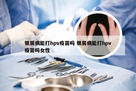 银屑病能打hpv疫苗吗 银屑病能打hpv疫苗吗女性