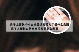 鼻子上面长个小白点最近发现大了是什么东西 鼻子上面长白色点点很多是怎么回事