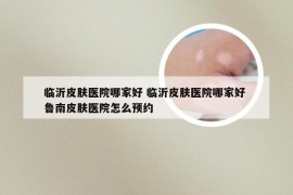 临沂皮肤医院哪家好 临沂皮肤医院哪家好 鲁南皮肤医院怎么预约